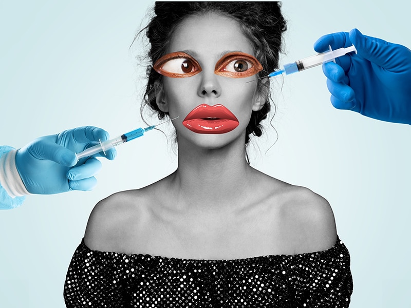 overdone facelift results